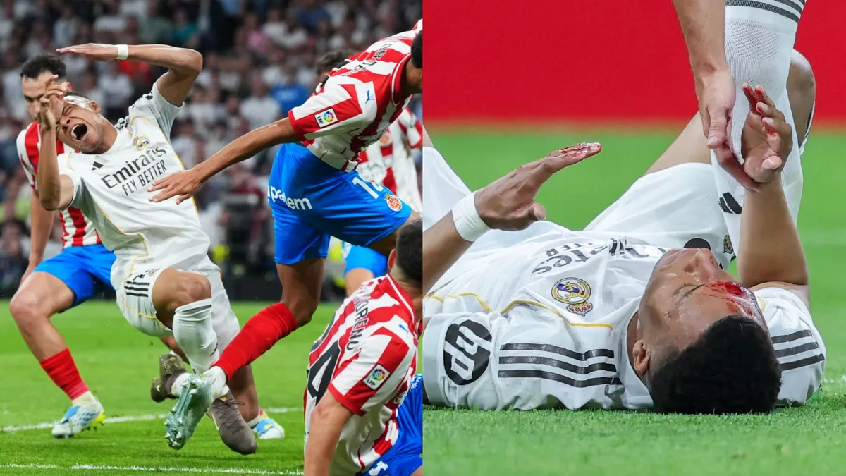 real madrid – girona — MA news